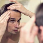 The Relationship Between Testosterone and Hair Loss